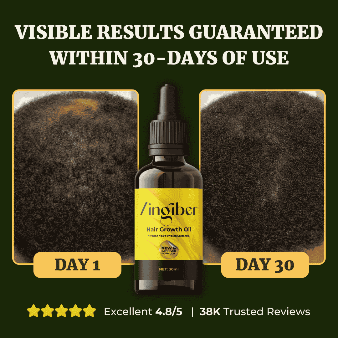 A Potent Blend Of 12+ Time Trusted Herbs & Oil For Thicker, Longer Hair, Fast! (1)